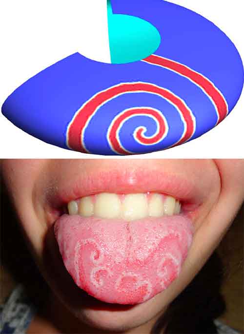 geographic tongue illustration